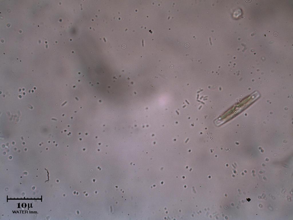 L''infinitamente piccolo