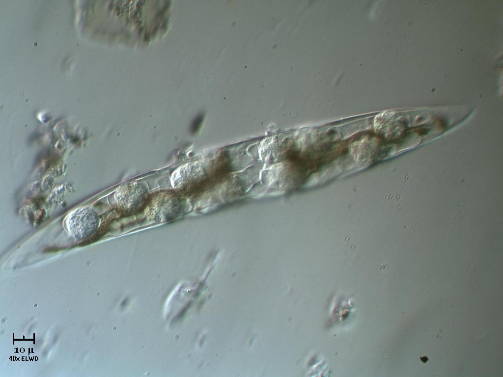 Cosa  successo a questo Closterium?