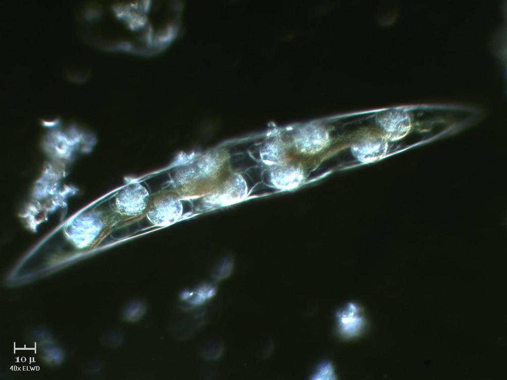 Cosa  successo a questo Closterium?