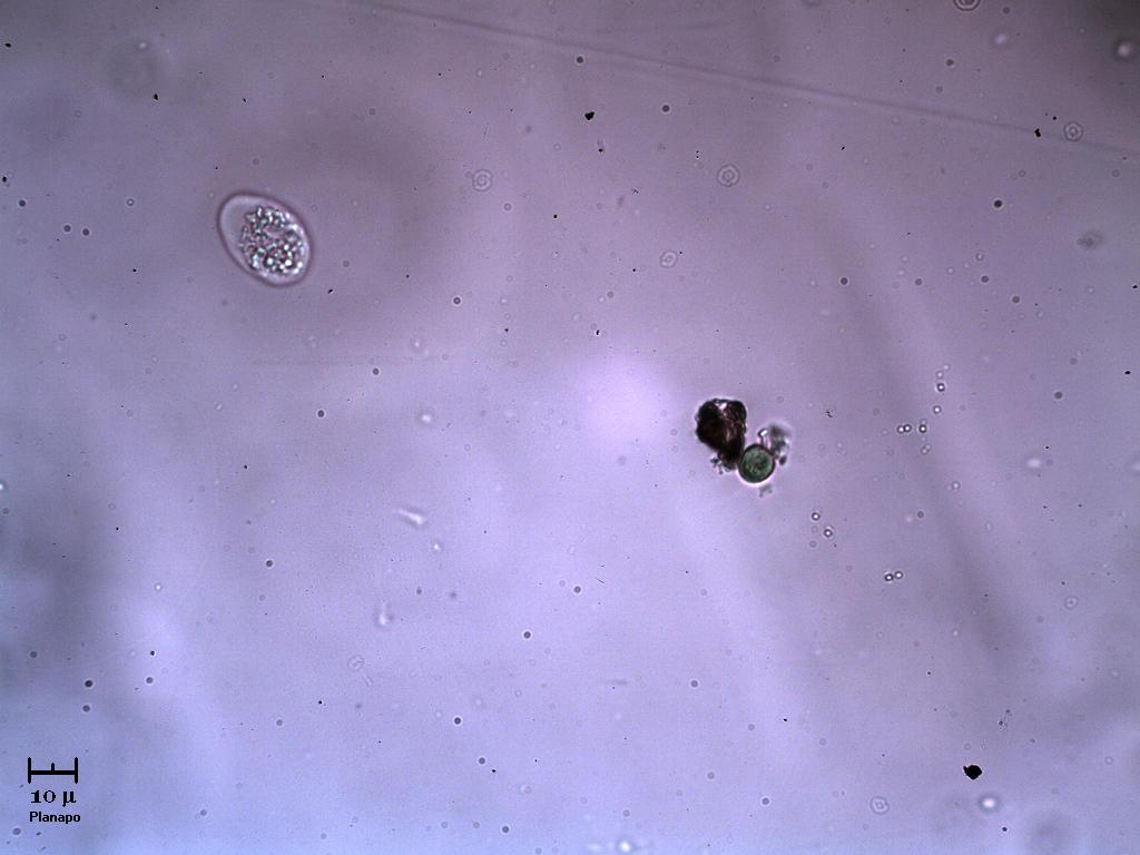 Cloroficea o Amoeba a seconda dei gusti