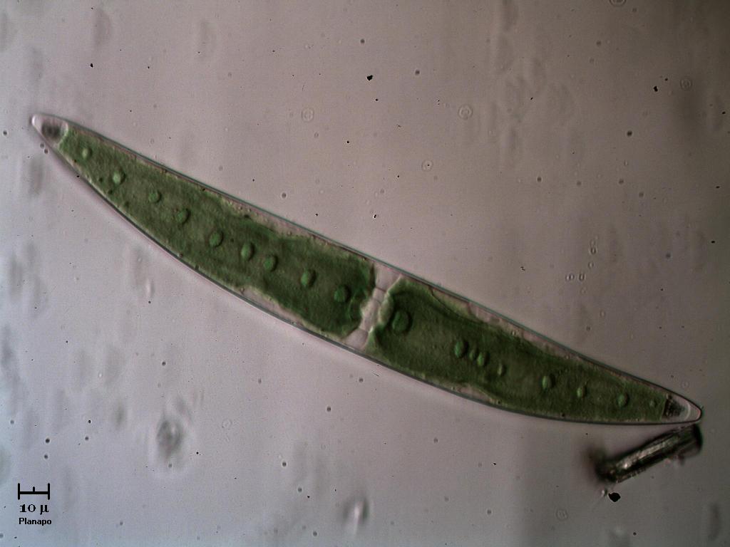Closterium