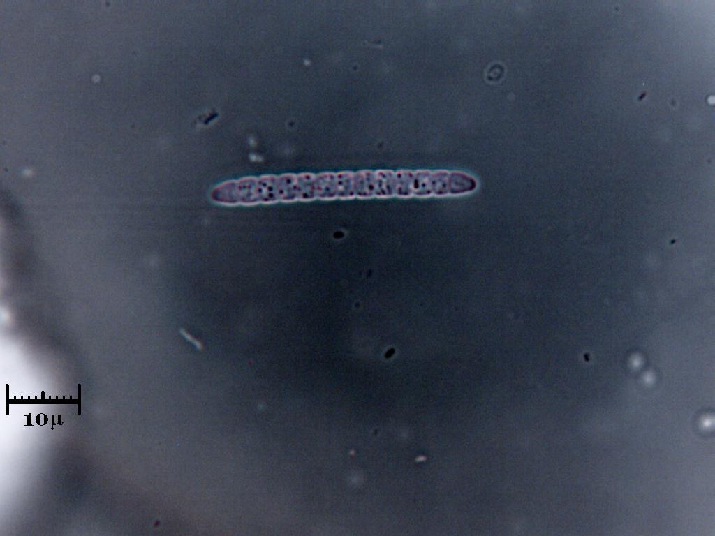 Procariota cianotico