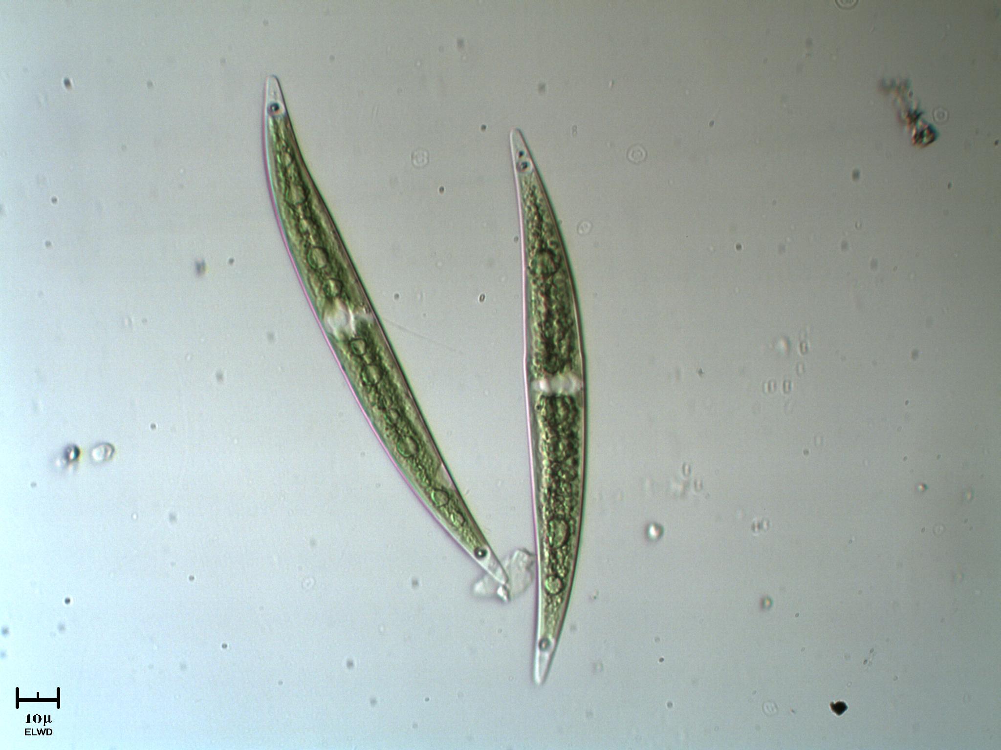 Offerta speciale [ Closterium sp.]