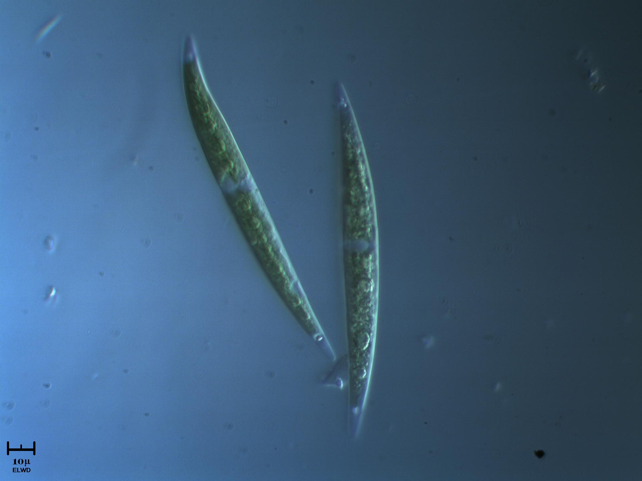 Offerta speciale [ Closterium sp.]