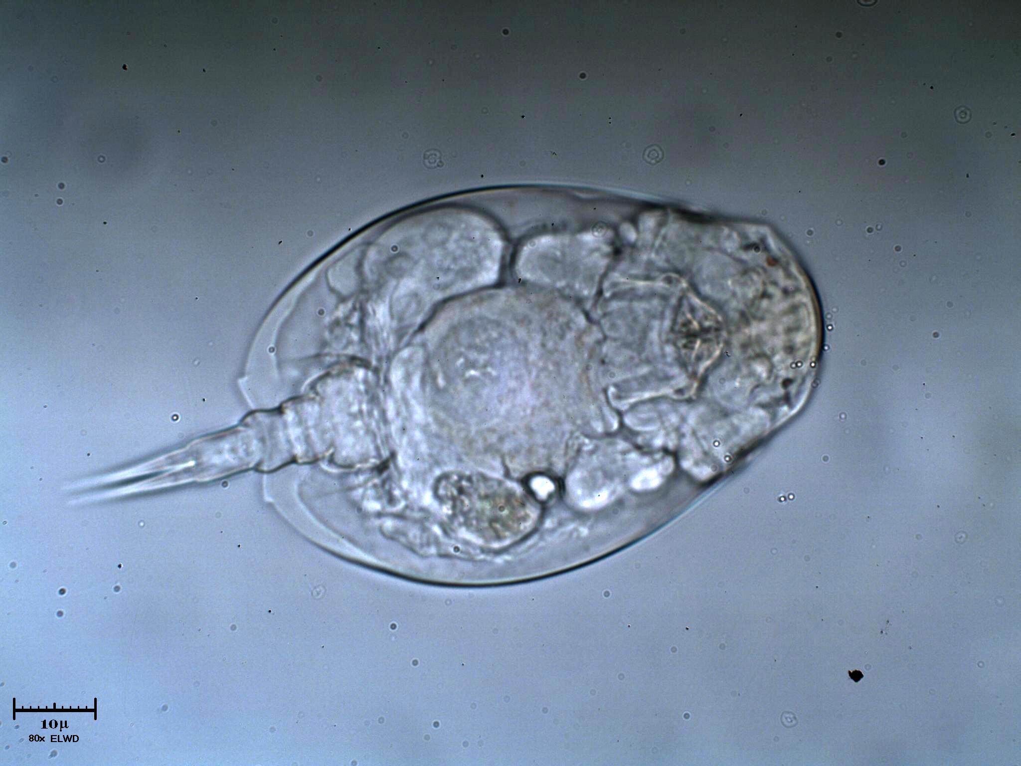 Geppe''s Euchlanis sp,