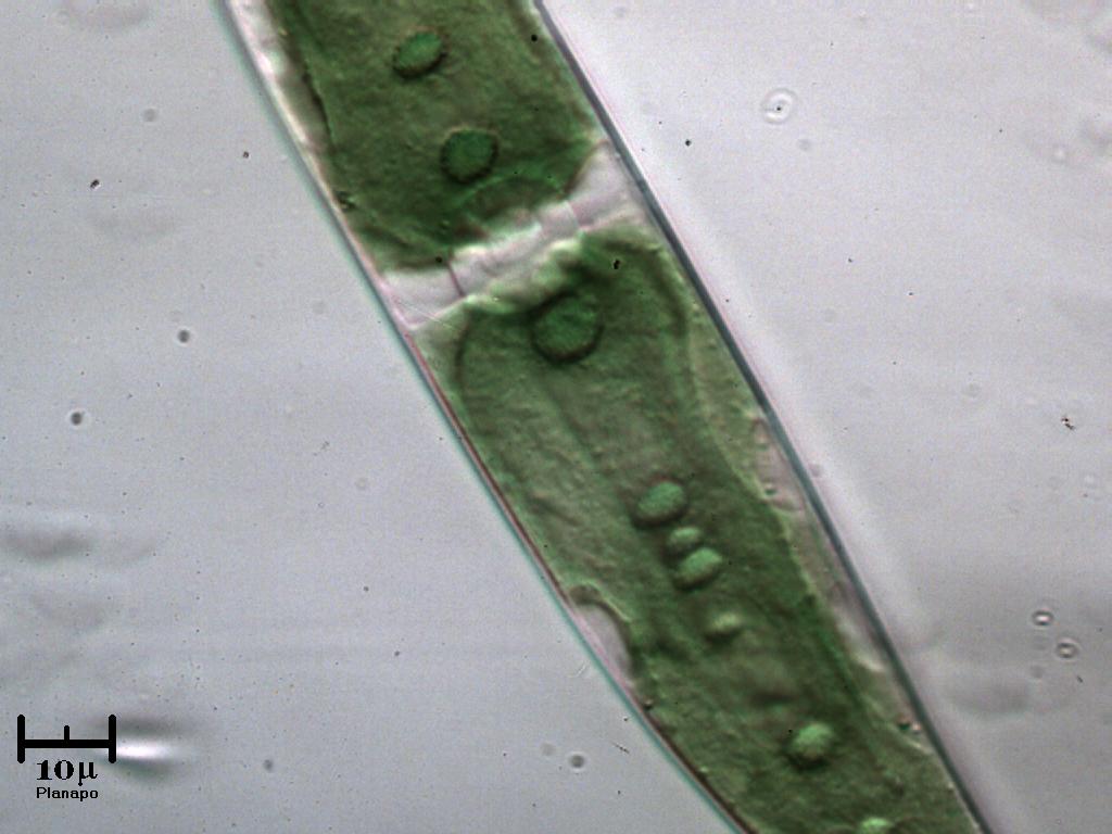 Closterium