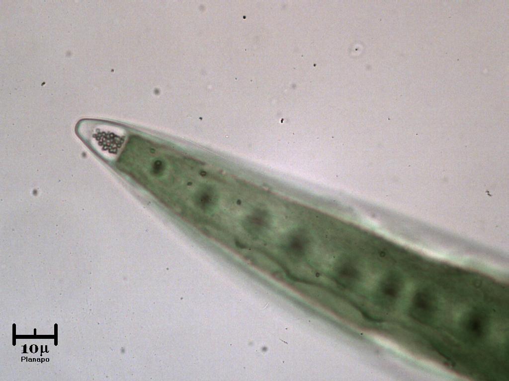 Closterium