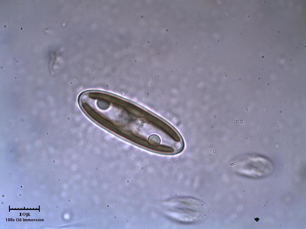 Diatoma?