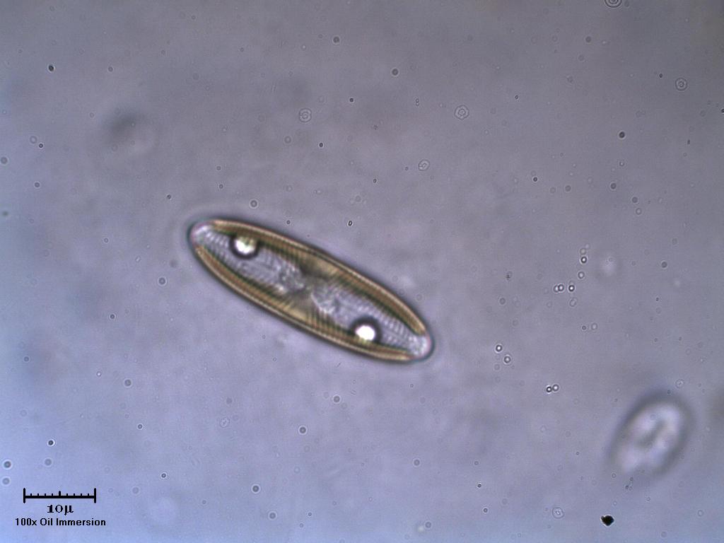 Diatoma?