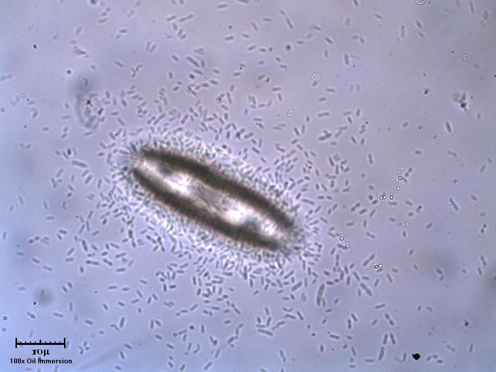Diatoma?