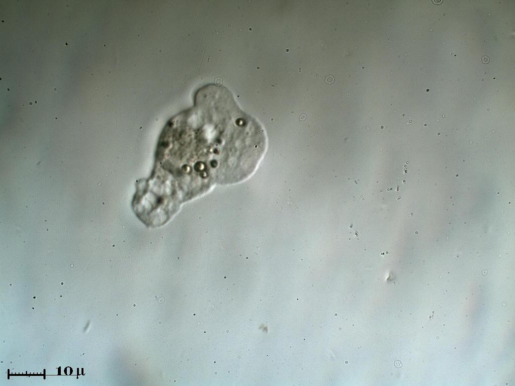 Amoeba