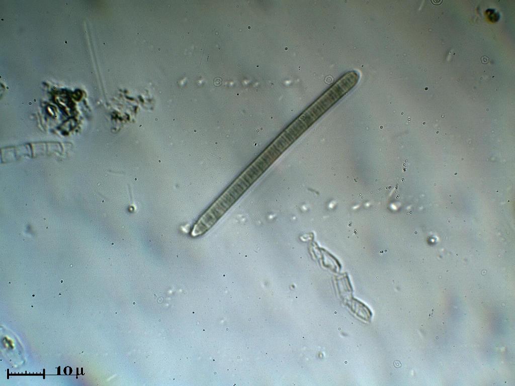 Cyanobacterio