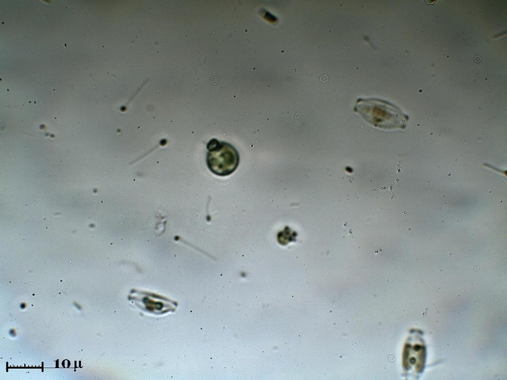 Unidentified