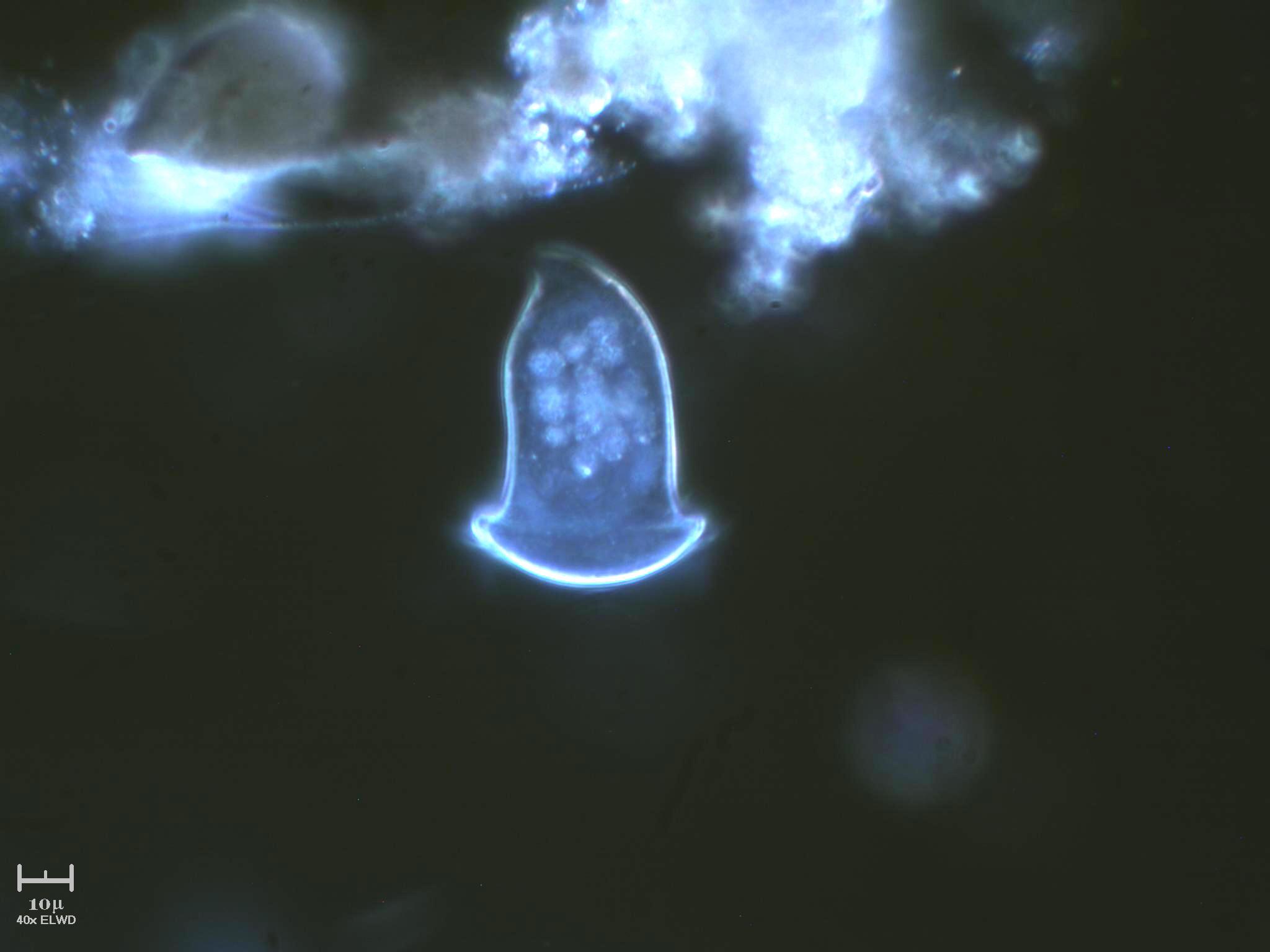 ESCOCAT - IL RITORNO  [ Vorticella sp. ]