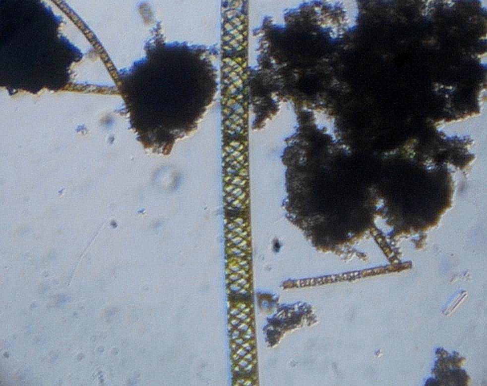 Spirogyra sp.