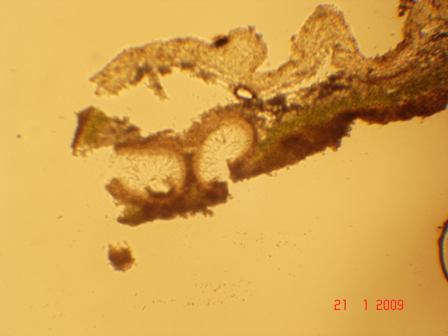 fungo lichenicolo o lichene?