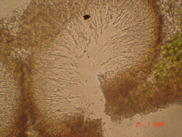 fungo lichenicolo o lichene?