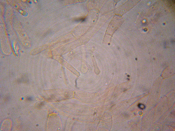 Raccolte del 9 Novembre