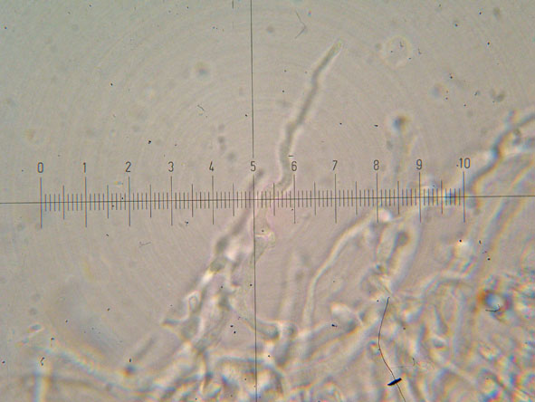 Obducta o floriformis? (Osteina obducta)