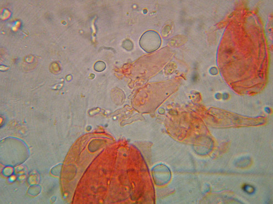 Mycena da determinare (cfr. Mycena galericulata)