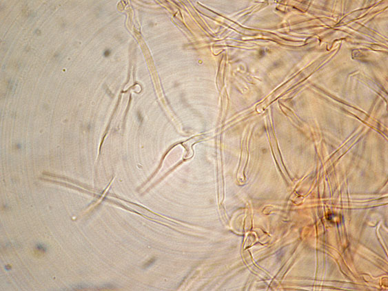 Ramaria da determinare