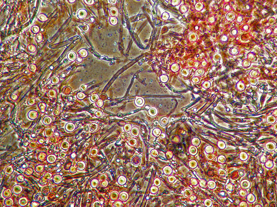 Aphyllophorales con clamidospore(Granulobasidium vellereum)