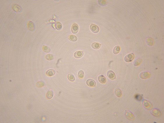 Piccola crosta su Ginestra (Hyphodontia juniper)