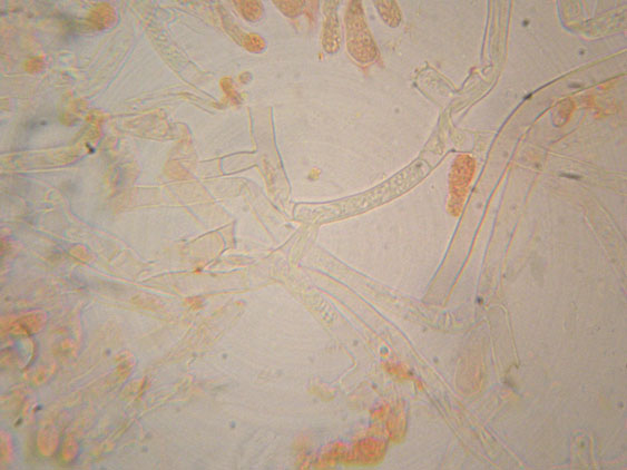 Da determinare (Athelia sp.)