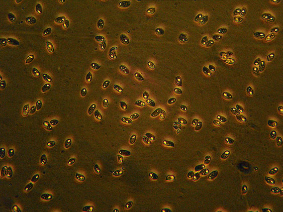 Quiz N.4 (Phaeolus schweinitzii)