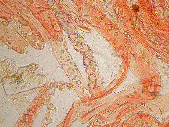 Pachyella lazzariana?