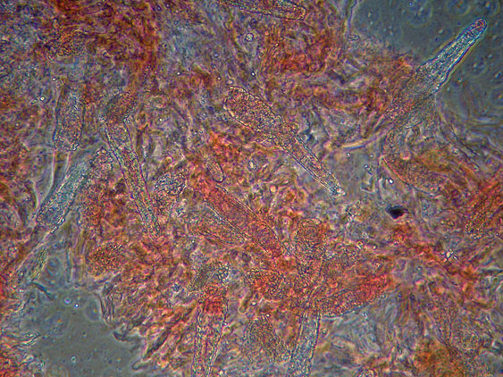 Rhizochaete radicata (Henn.) Gresl., Nakasone & Rajchenb.