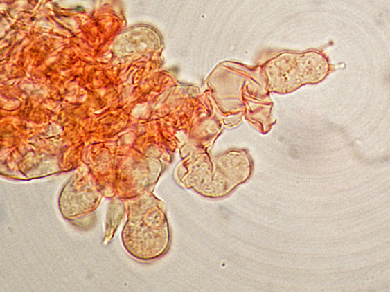 Botryobasidium subcoronatum