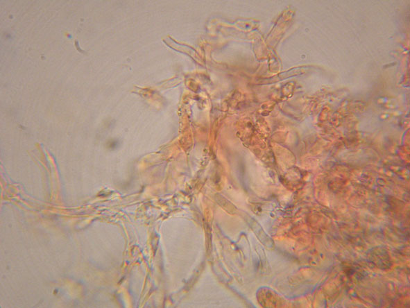 Hyphoderma roseocremeum? (Hyphoderma roseocremeum)