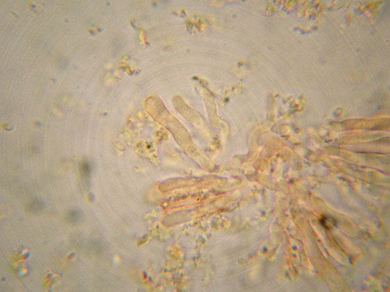 Da determinare (Ceraceomyces serpens)
