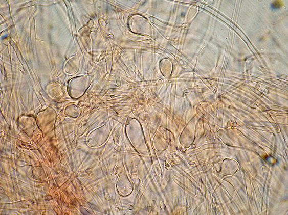 Ramaria da determinare