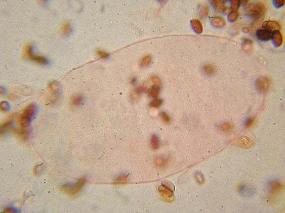 Coprinellus micaceus