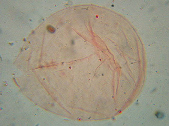 Raccolte del 30 e  31 Maggio