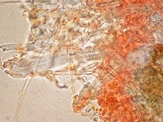 Tubulicrinis subulatus