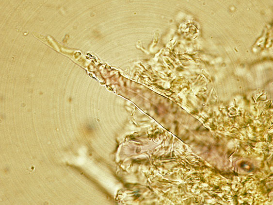 Tubulicrinis subulatus