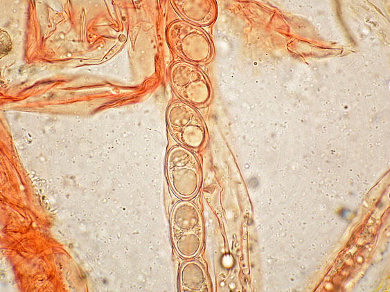 Pachyella lazzariana?