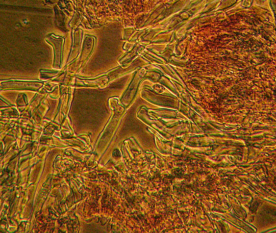 Phanerochaete con Gaf?