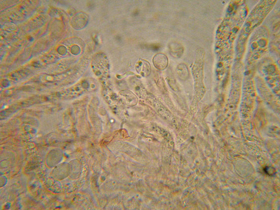 Radulomyces confluens