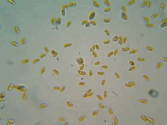 Phanerochaete da determinare (Phanerochaete sordida)