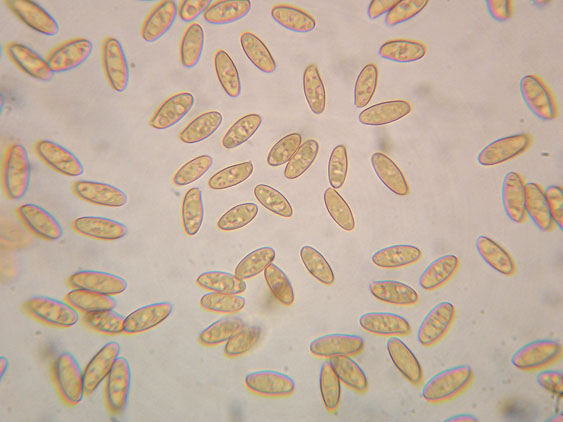 Xerocomus cisalpinus?