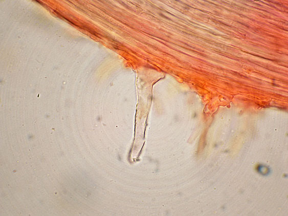 Mycenella margaritispora (J.E. Lange) Singer