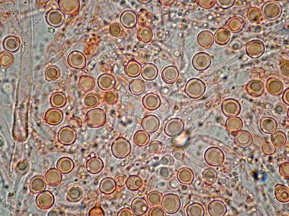 Aphyllophorales con clamidospore(Granulobasidium vellereum)