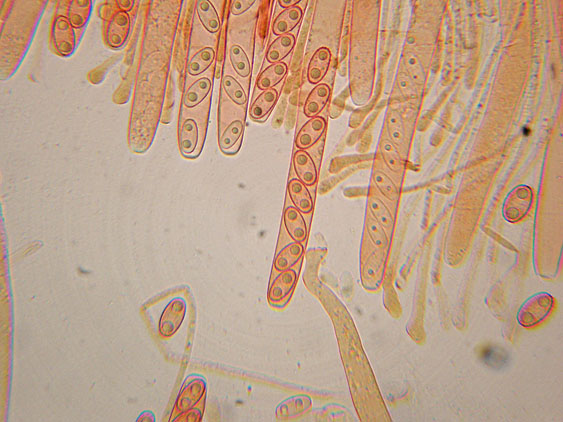 Peziza da determinare