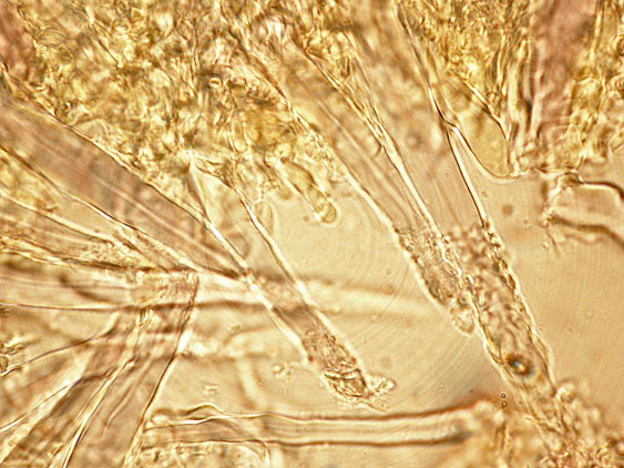Tubulicrinis subulatus