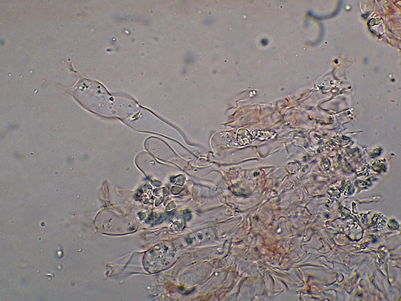 Peniophorella praetermissa (P. Karst.) K.H. Larss.