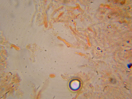 Crosticina senza rizomorfe (Trechispora confinis)